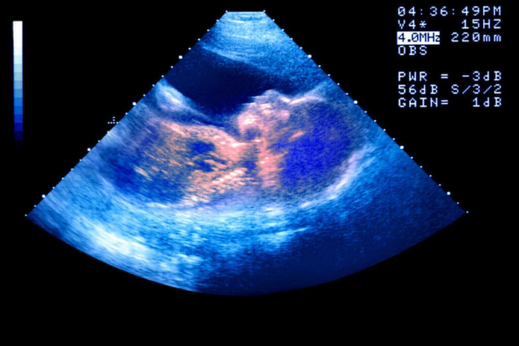 A baby's profile is seen on a sonogram.
