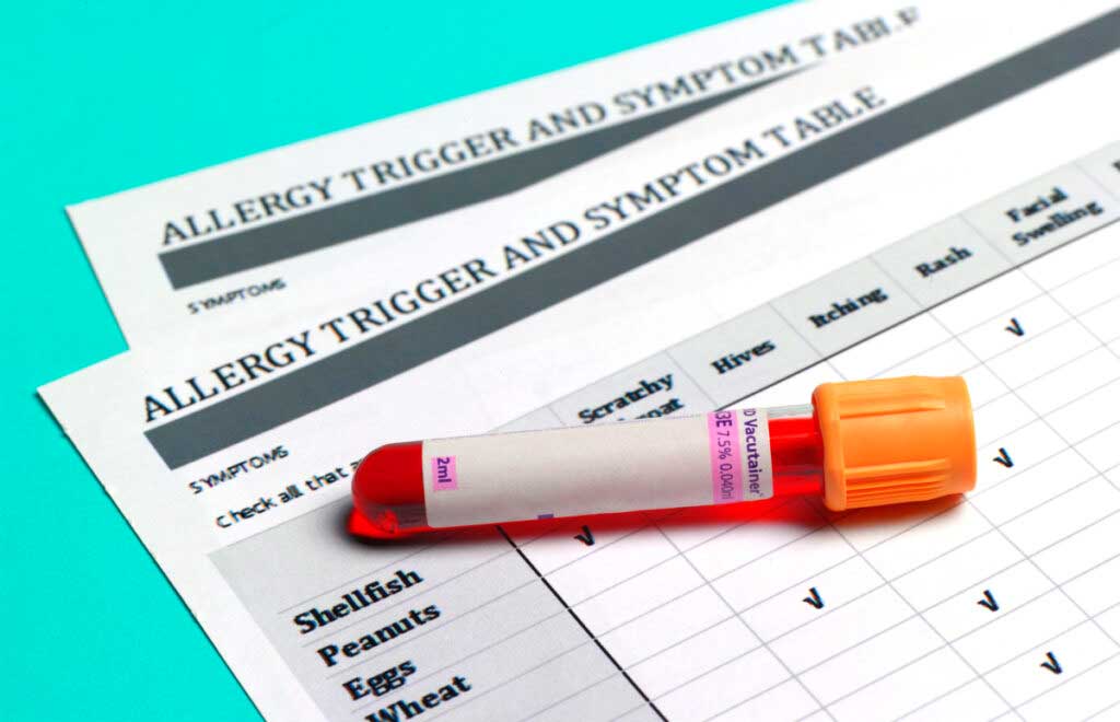 Blood sample lies on an allergy test sheet.