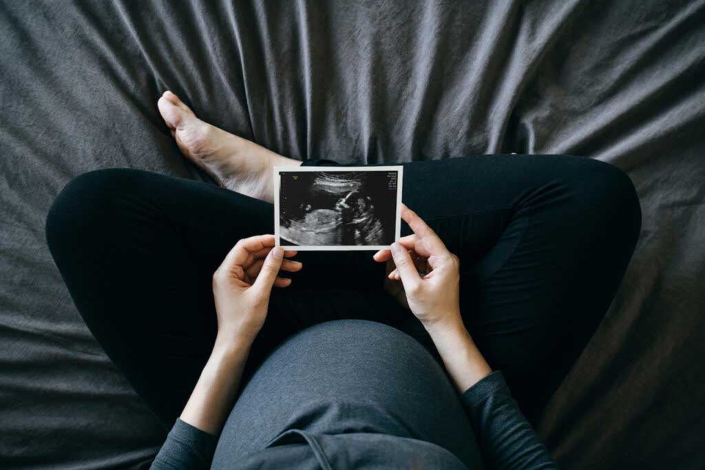 A shot from above of a person holding an ultrasound photo in front of her pregnant stomach.