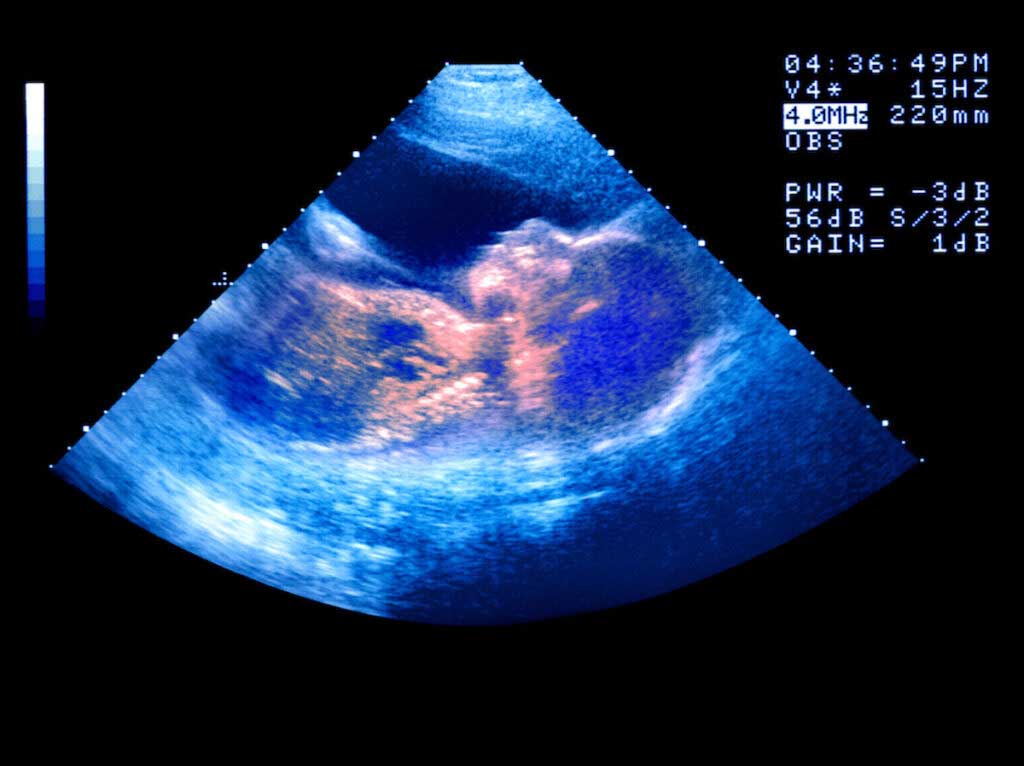 A baby's profile is seen on a sonogram.