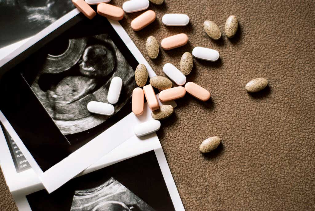Prenatal vitamins scattered over images from a sonogram.