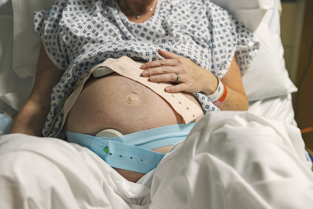 Close-up of a pregnant belly with monitors wrapped around.