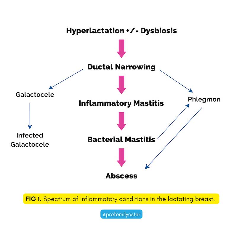 A flow chart to show the causes of mastitis.