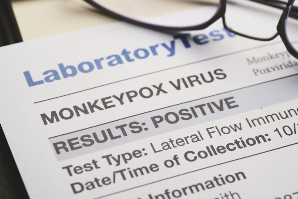 A laboratory test sheet for the Monkeypox virus.
