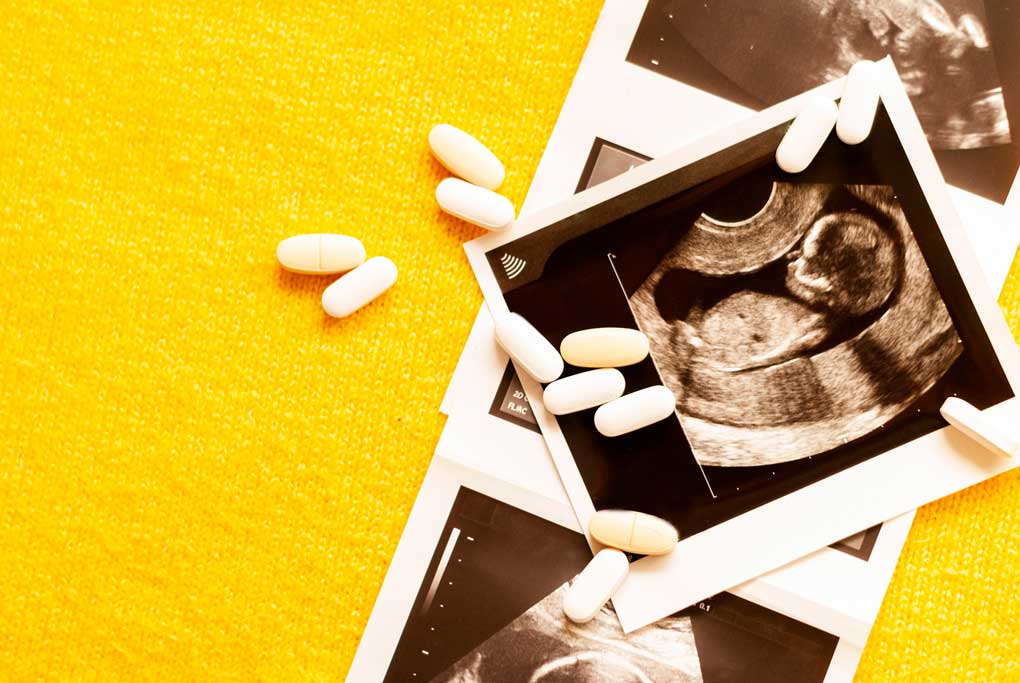 Sonagram images are overlayed with prenatal vitamins on a yellow background.