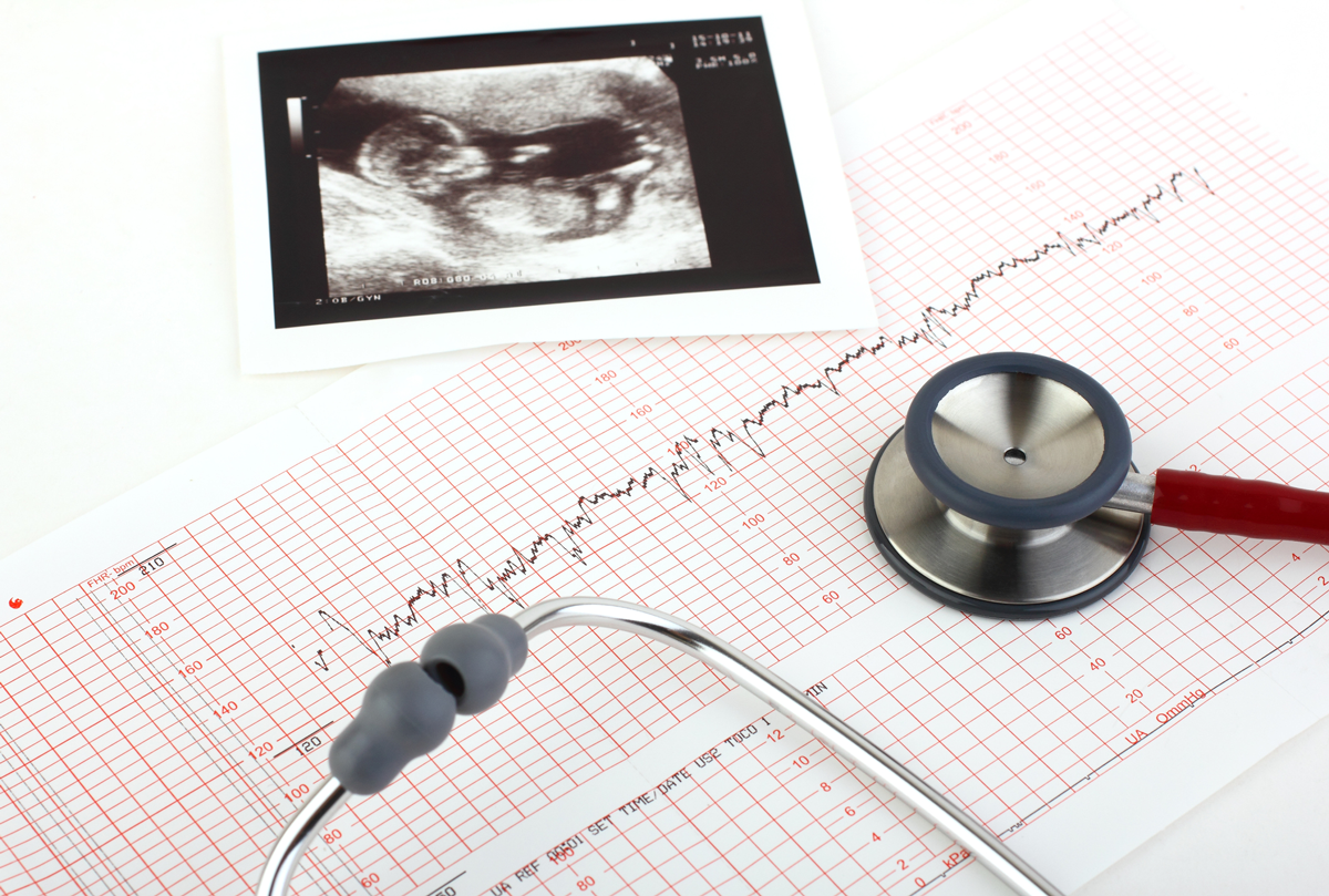 An ultrasound picture, a stethoscope and a readout of a heart monitor are seen on a physician's desk.