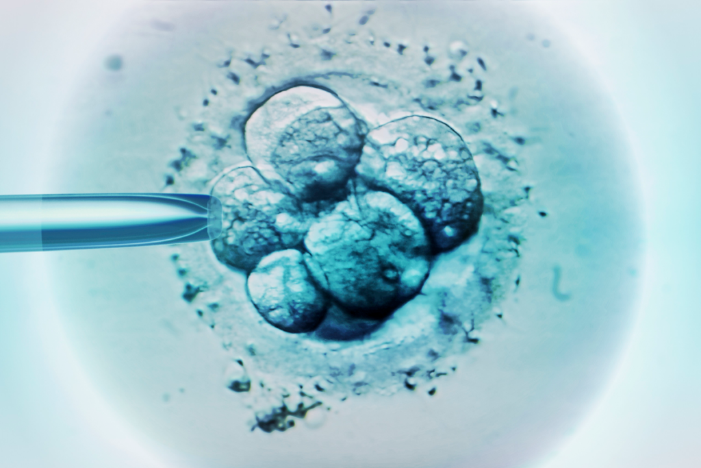 Image of cells and a needle from an IVF procedure.