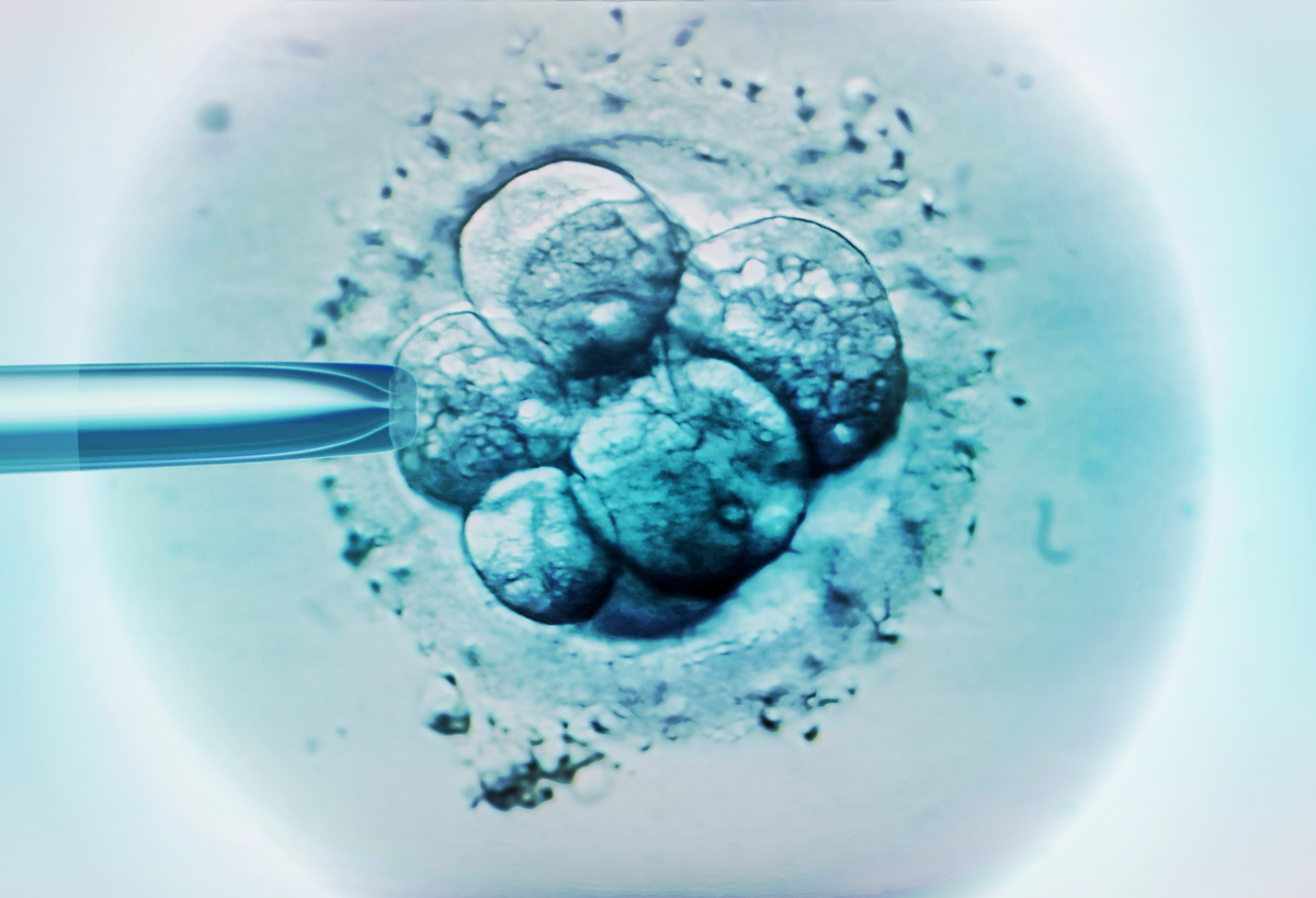 Image of cells and a needle from an IVF procedure.