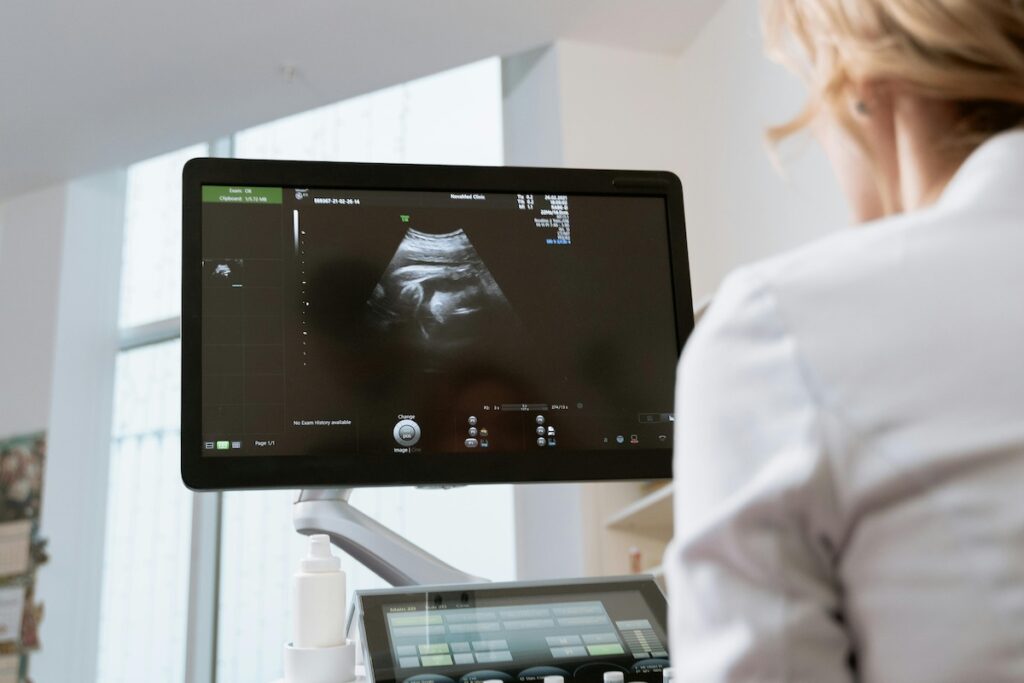 Person looking at ultrasound screen