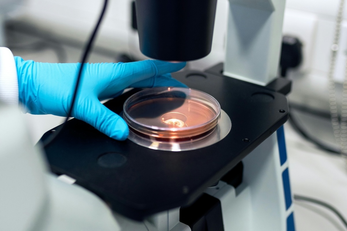 Petrie dish being held by a gloved hand under a microscope