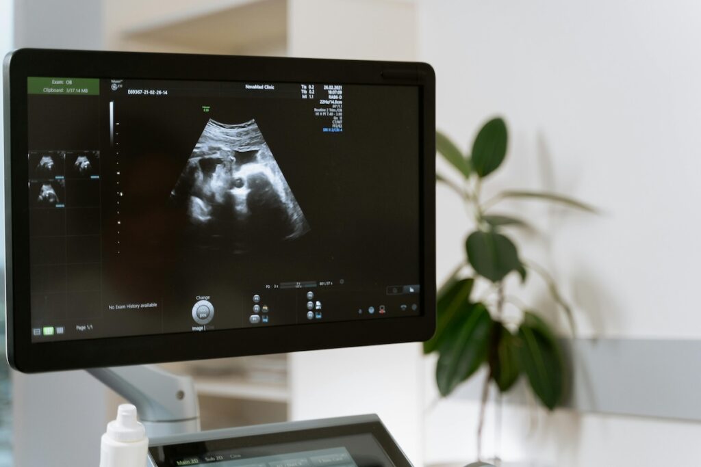 Ultrasound image of pregnancy