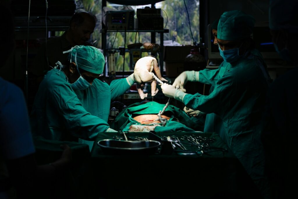 medical doctors in the operation theater performing surgery