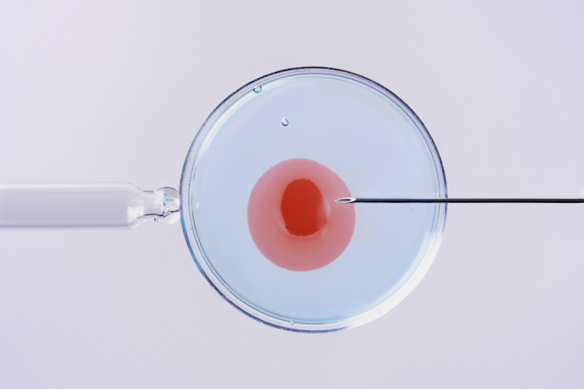 A petri dish containing an Ovum injected with a sperm