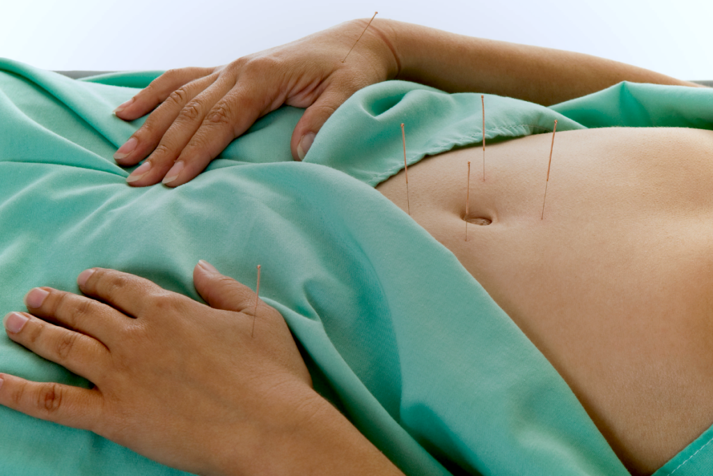 A person having accupuncture needles in their stomach