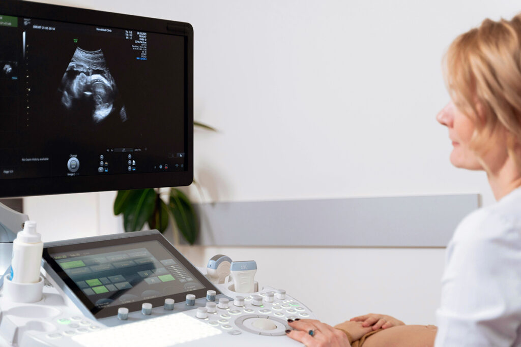 A doctor looking at an ultrasound scan