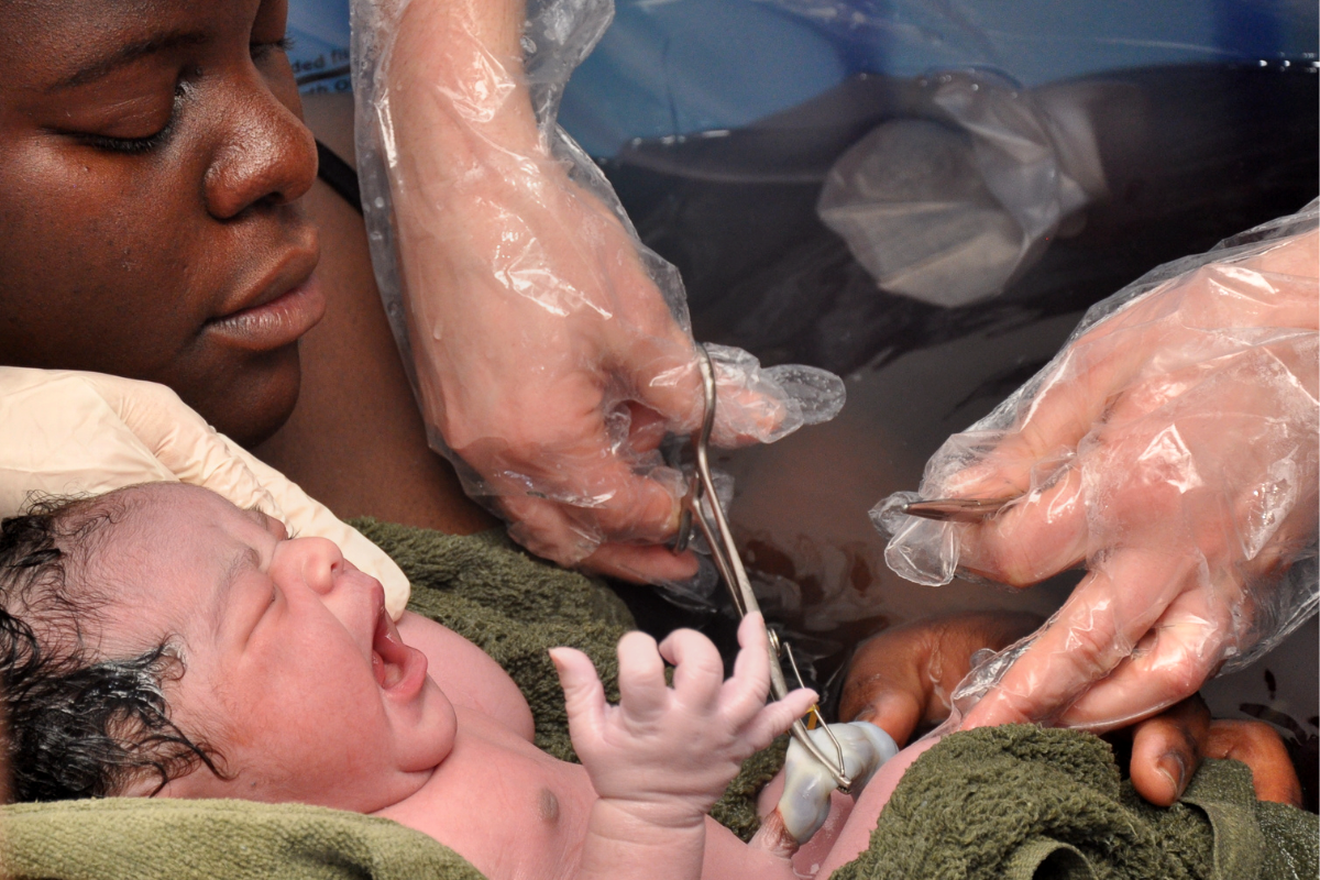 Placenta being cut during delivery