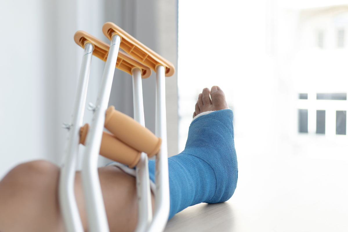 A person's leg in a cast on table.
