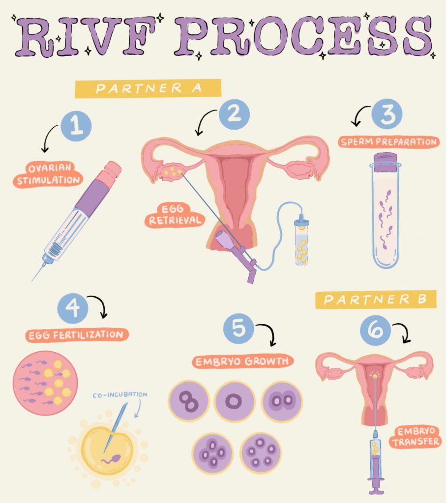 Illustration of the RIVF process