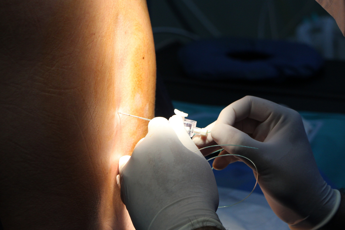 A pregnant person getting an epidural.